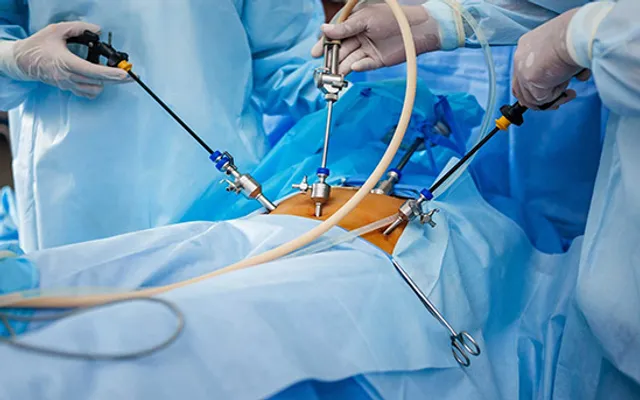 Hands On Laparoscopic Training Centre | Laparoscopic Surgery Training Centre in India