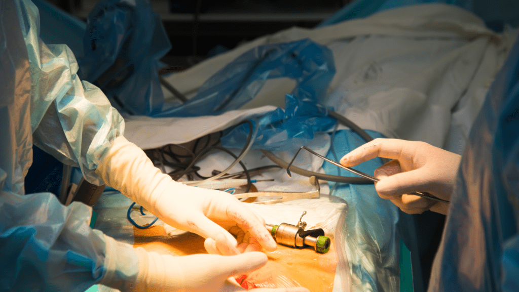 Laparoscopy in Surgery Gynecology and Urology