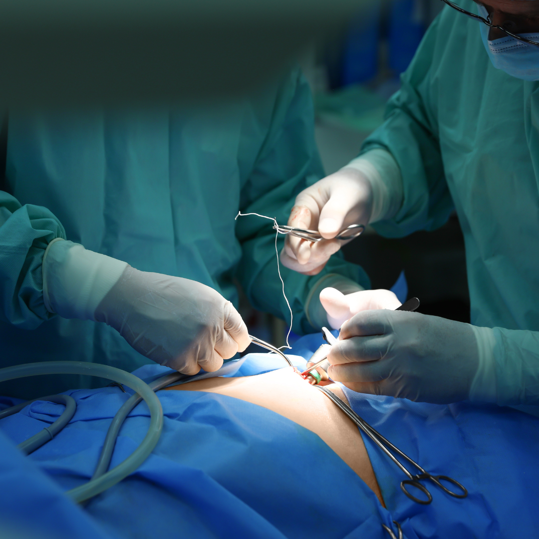 laparoscopy training for gynaecologists in india | the Medicity