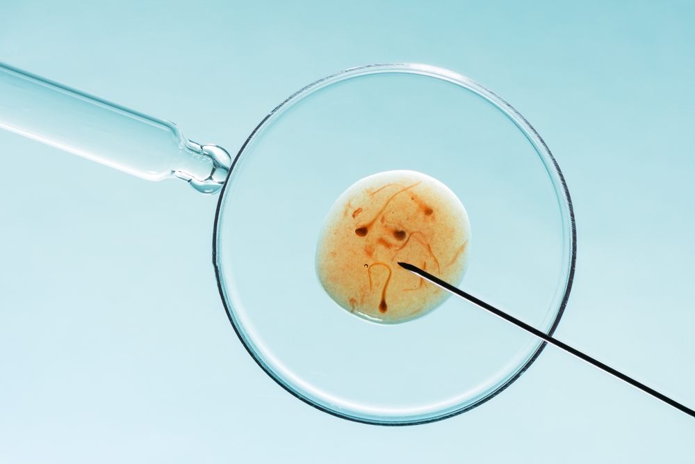 Real Hands-On IVF Training in India