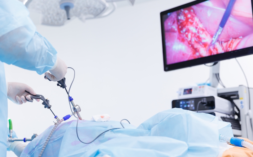 Laparoscopic Surgery Training Centre in India