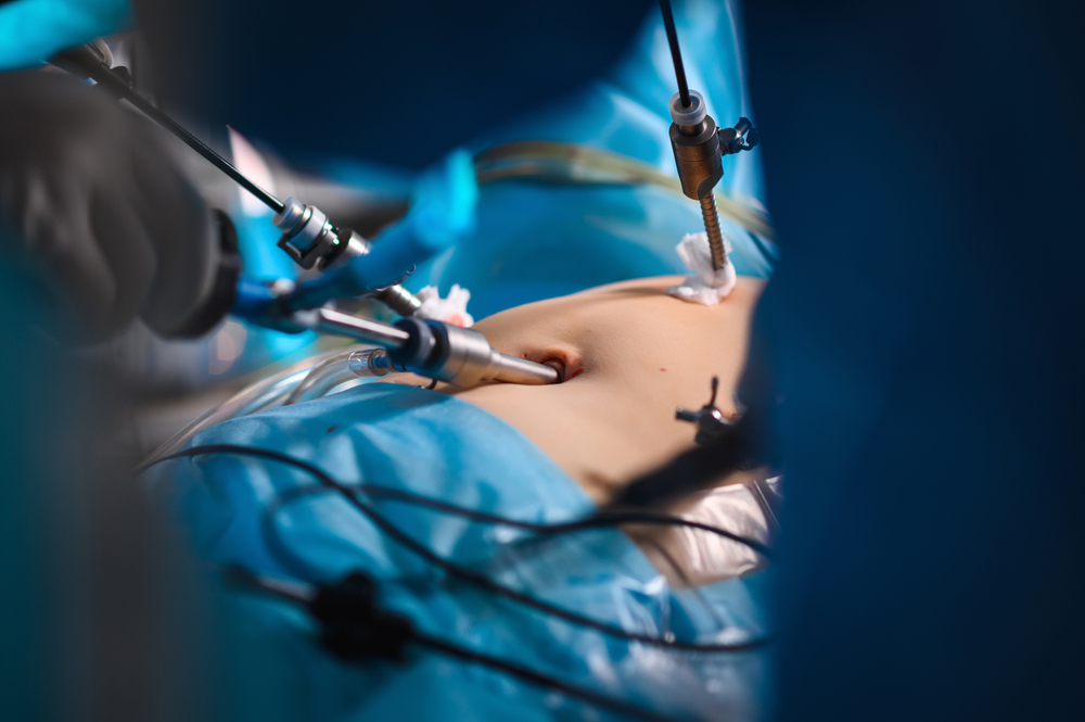 Minimally Invasive Surgery Hands-On Laparoscopic Training